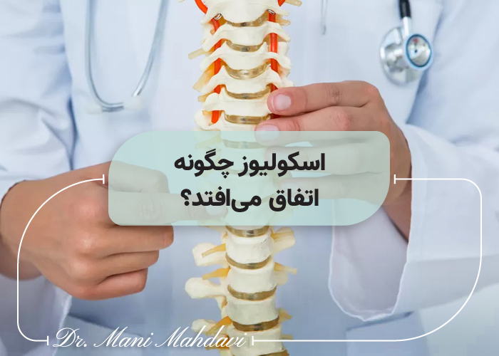 اسکولیوز چگونه اتفاق می افتد؟